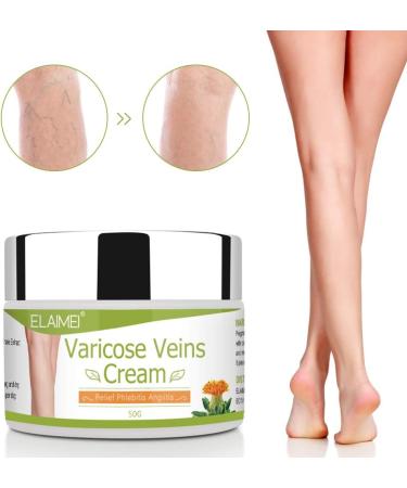Varicose Veins Treatment Cream 50G - Spider Vein Relief for Tired, Heavy Legs | Strengthen Capillaries, Improve Leg Appearance - Buy Online on SooperMarket.com
