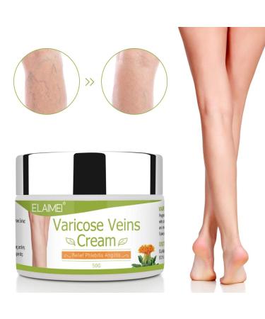 Varicose Veins Cream - Treatment for Phlebitis, Angiitis, Vasculitis, Spider Veins - Improve Blood Circulation for Tired, Heavy Legs - Fast Relief - Buy Online on SooperMarket.com