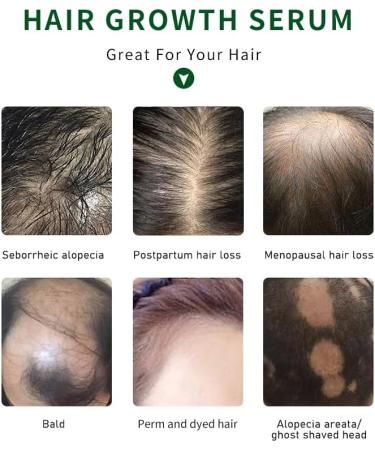 PrimeCove - Biotin & Tea Tree Hair Growth Serum (30ml) | Stimulate Growth Reduce Graying & Nourish Roots | Advanced & Natural Formula - Buy Online on SooperMarket.com