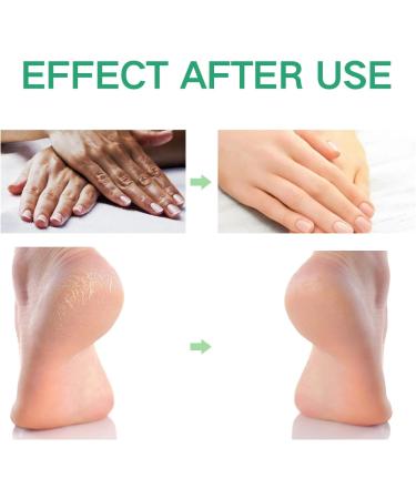 Foot Cream for Very Dry Feet Cracked Heel Repair Cream Callus Remover Foot Moisturiser Hard Skin Remover Foot Soften & Smooths Feet Deep Moisturizing Nourishing Formula for Feet Care - Buy Online on SooperMarket.com