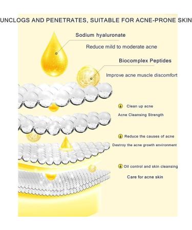 Gentle Acne Serum for Face Acne Treatment Essence Relief Pimple Pigmentation Blackhead Brighten Shrink Smooth Skin Redness Relief Face Acne Spot Treatment Repair Skin for Acne Skin - Buy Online on SooperMarket.com