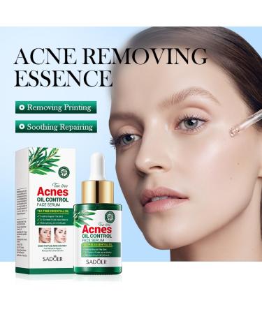Tea Tree Oil for Face - Acne Serum & Blemish Spot Treatment - Unclogs Pores Soothes Breakouts - 1 fl oz for Smooth Glowing Skin - Buy Online on SooperMarket.com