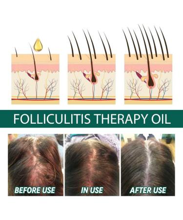 FIOERDTUIE Adults Hair Growth Essential Oil Follicle Repair Moisturizing Nourishing Essence Haircare Serum Beauty Supplies - Buy Online on SooperMarket.com