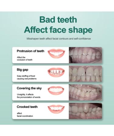 Risely Temporary Whitening Veneers - 2 Pairs of Artificial Teeth for Men & Women | Plug-In Braces & Lightening Dentures - Buy Online on SooperMarket.com