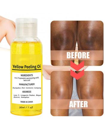 Super Strength Yellow Peeling Oil for Dark Skin - 30/50ml Exfoliating Lightening Treatment - Extra Strength for All Skin Types - Buy Online on SooperMarket.com