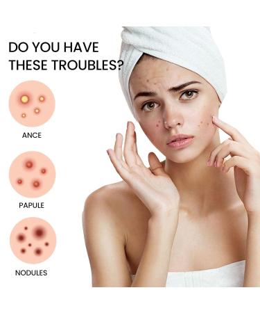 200 Star Shaped Pimple Patches - Hydrocolloid Acne Spot Cover Stickers for Effective Skin Care | International Shipping Available - Buy Online on SooperMarket.com
