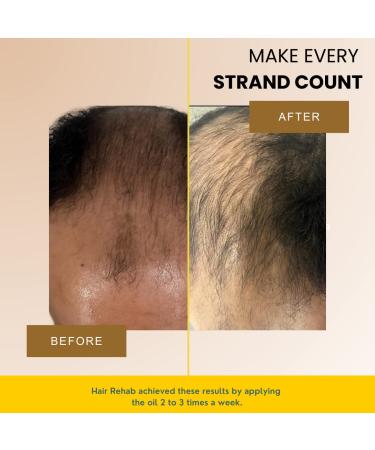 Keauty Lifestyle Hair Rehab Hair Growth Oil - Stimulates Hair Follicles for Stronger, Thicker & Healthier Hair - 10 Essential Natural Oils - Proven Results - 24 Fl Oz - Buy Online on SooperMarket.com