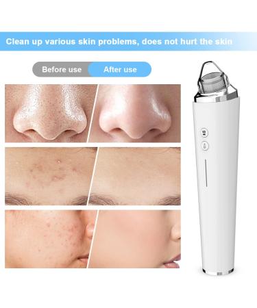 Silkwish Electric Blackhead Remover Pore Vacuum with HD Camera - USB Rechargeable Kit for Women & Men - Buy Online on SooperMarket.com