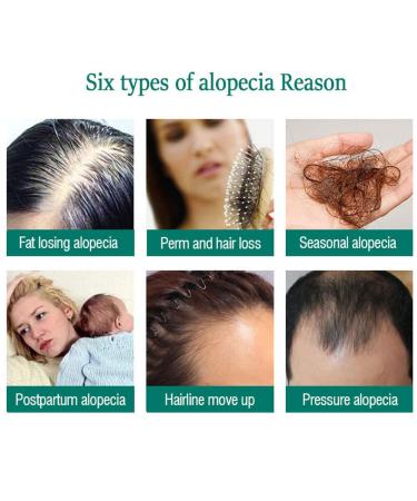Hair Growth Serum - Thicker Longer Fuller Hair | Prevent Hair Loss & Thinning | Vitamin-Rich Natural Treatment - Shop Now - Buy Online on SooperMarket.com