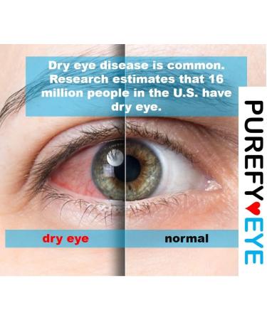 Buy PUREFYEYE 4oz Hypochlorous Eyelid Cleanser - Relief for Dry Eye Rosacea Pink Eye | Gentle & Hypoallergenic Daily Care - Buy Online on SooperMarket.com