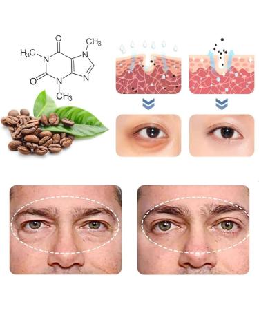 CHUANGJIA OPENEYES Peptide Lifting Eye Gel Set - Reduce Bags, Wrinkles, Dark Circles - 3PCS - Buy Online on SooperMarket.com