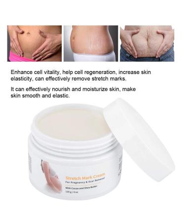 Stretch Stripes Cream 120g | Remove Stretch Marks Pregnancy Scars & Acne | Maternity Repair Treatment - Buy Online on SooperMarket.com