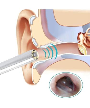 KANDUO Ear Wax Removal 5.5mm Otoscope with LED Lights - Ear Cleaning Camera Tool - Buy Online on SooperMarket.com