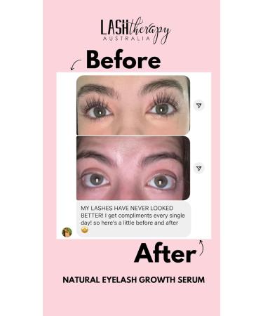 Lash Therapy Australia Eyelash Growth Serum - Promotes Natural Lash Growth - Buy Online on SooperMarket.com