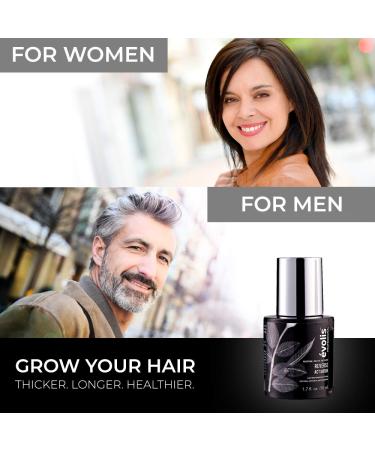 volis REVERSE Activator Hair Growth Treatment - Keratin Formula for Thinning Hair - Accelerates Growth, Reduces Hair Fall - Scalp Treatment for Hair Regrowth (1.7 fl oz) - Buy Online on SooperMarket.com