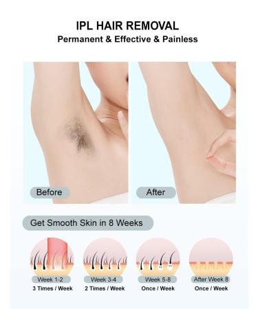 At-Home IPL Laser Hair Removal Device - 999 999 Flashes Painless Hair Remover for Men & Women | Face Legs Arms Bikini Line - Buy Online on SooperMarket.com