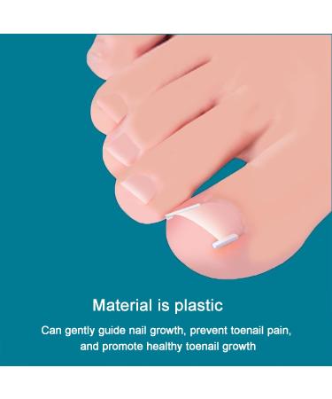 Ingrown Toenail Correction Set - 42 C-Shaped Fill Padding | Simple Tool for Ingrown Toenail Relief - Buy Online on SooperMarket.com