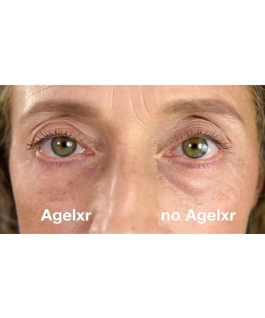 AGELXR Instant Wrinkle Remover Serum | Tightens Wrinkles & Fine Lines | Diminishes Puffy Eyes | Anti-Aging Formula with Argireline | 10 Vials - Buy Online on SooperMarket.com