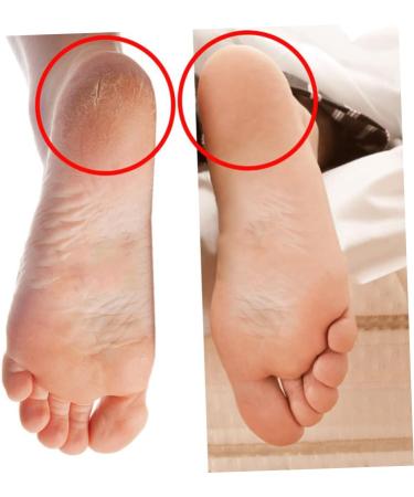 minkissy 6 Pairs Heel Socks for Cracked Heels Heel Protectors for High Heel Shoes Moisturizing Sleeves Foot Softening Socks Silicone Heel Cover Moisturizing Socks Anti Slip Socks Increased - Buy Online on SooperMarket.com