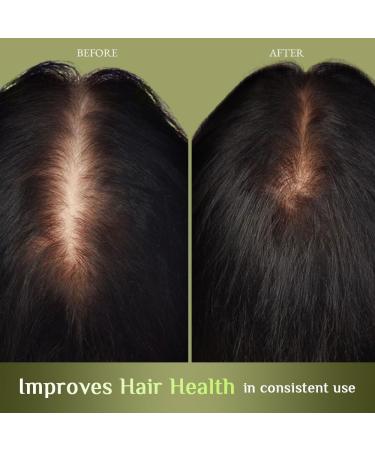 Richfeel Brahmi Jaborandi Nourishing Hair Oil - Strengthens Nourishes Promotes Growth and Soothes | 80 ml - Buy Online on SooperMarket.com