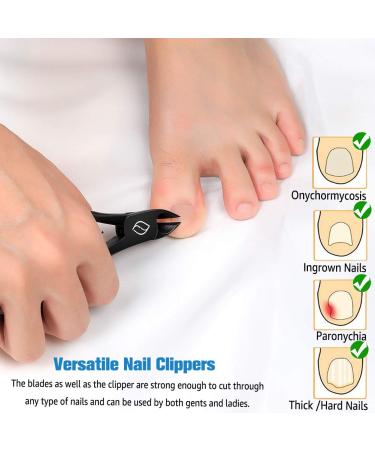 FERYES Precision Toenail Clipper | Stainless Steel Nail Cutter for Thick or Ingrown Toenails | Podiatrist Recommended | Manicure Pedicure Clipper - BLACK - Buy Online on SooperMarket.com