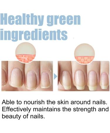 HOPASRISEE Onyxoguard Nail Growth and Repair Serum Onyxoguard Serum Nail Strengthener Nail Growth Serum Nail Growth and Strengthener Nail Serum for Strength and Growth (1) - Buy Online on SooperMarket.com