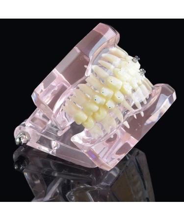 LBYLYH Orthodontic Demonstration Model - Teeth Teaching Tools with Metal & Ceramic Support for Effective Dental Treatment - Buy Online on SooperMarket.com