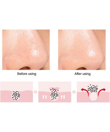 Silicone Nose & Lip Cleansing Brush Set for Blackhead & Exfoliation - Rose Red - Buy Online on SooperMarket.com