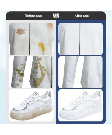 LONGLUAN Stain Removal Wet Wipes Clothes Stain Removal Wipes 20Pcs/Bag Stain Remover Wipes Individual Wrapped Cleaning Wipes Emergency Stain Rescue Stain Remover for Cleaning Clothes (2Pack) - Buy Online on SooperMarket.com