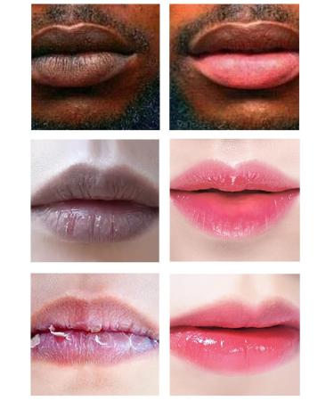 H.D.S.N. Lip Scrub 20g - Natural Exfoliator for Dry & Dark Lips - Moisturizing Balm for Smokers - 0.7 Fl Oz (Pack of 1) - Buy Online on SooperMarket.com