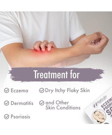 Eczema Soap Bar for Face and Body - All Natural Dermatitis & Psoriasis Treatment - Gentle Relief for Dry, Itchy, Flaky Skin - Made in USA - 4 oz Bar (Pack of 1) - Buy Online on SooperMarket.com