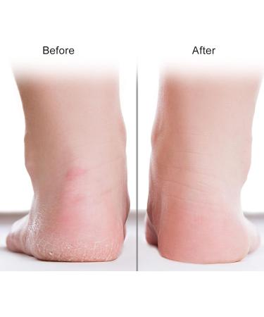 Moisturizing Gel Foot Socks Repair Dry Cracked Feet Heel Socks with Breathable Holes Foot Care Socks Protector - Buy Online on SooperMarket.com