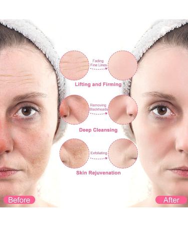 YBLNTEK Professional Diamond Microdermabrasion Machine for Face and Body - Acne Treatment with 5 Tips and 100pcs Filters - Buy Online on SooperMarket.com