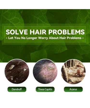 Eczema Psoriasis Anti Dandruff Shampoo for Soothing Dry, Itchy Scalp (200ml) - Buy Online on SooperMarket.com
