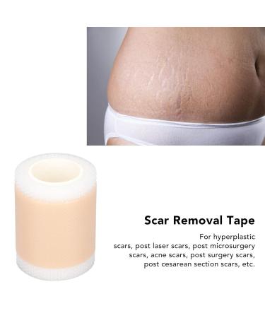 Self-Adhesive Reusable Scar Tape Roll for Postpartum Recovery | Scar Gel Tape - Buy Online on SooperMarket.com