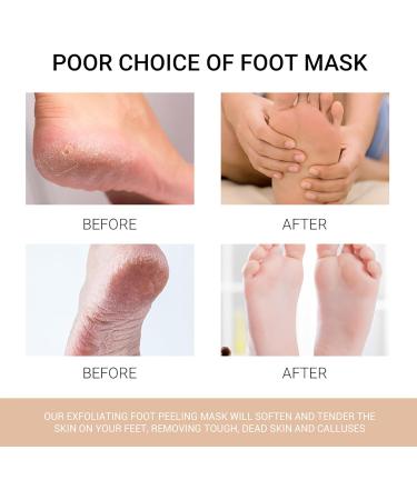 Foot Mask - 3 Pairs Peeling & Moisturizing Socks for Dry Cracked Feet - Foot Spa Treatment for Men & Women - Buy Online on SooperMarket.com