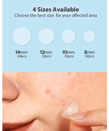 LitBear Acne Pimple Patches - Day and Night Set | 180 Dots with Witch Hazel, Tea Tree & Calendula Oil | Extra Adhesion for Face | Zit Patch AM + PM - Buy Online on SooperMarket.com