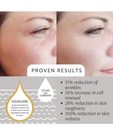 Squalane Absolute - EWG Verified for Skin Texture Tone & Youthful Radiance | 30ml/1oz - Shop Internationally - Buy Online on SooperMarket.com
