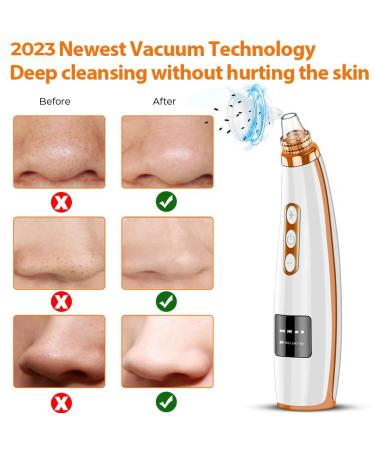 2023 Blackhead Remover Pore Vacuum - Upgraded Electric Facial Cleaner for Acne, Whiteheads - 5 Suction Power, 5 Probes - USB Rechargeable Kit for Women & Men - Buy Online on SooperMarket.com