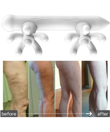 Anti-Cellulite Massager - Manual Fascia Massage Device for Myofascial Relaxation & Tension Relief | Perfect for Men & Women - Buy Online on SooperMarket.com