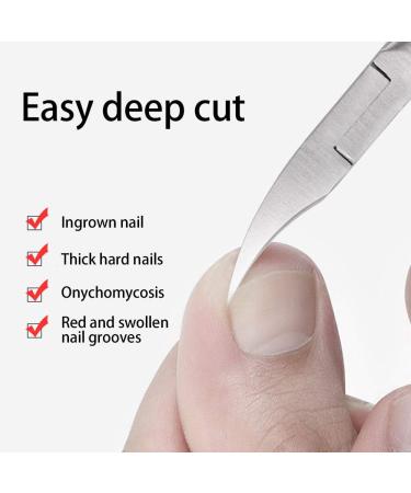 Pedicure Scissors Pedicure Scissors Nail Clippers ingrown toenail Clippers Tool for Men and Women Removal of Dead Skin Premium Stainless Steel Nail Pliers (F1) - Buy Online on SooperMarket.com