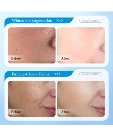 Hyaluronic Acid Anti-Wrinkle Cream Hyaluronic Acid Moisturiser Face Women & Men Anti Aging Face Cream Face Moisturiser For Mature & Young Skin Hydrate Smooth Dry Skin - Buy Online on SooperMarket.com