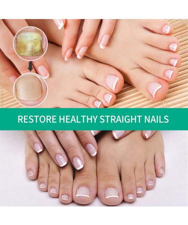 Nail Fungus Removal Liquid - Natural Toenail Fungus Oil for Effective Nail Care | BTSEURY - Buy Online on SooperMarket.com