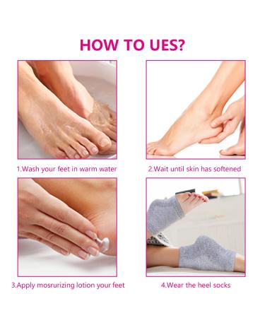 3 Pairs Moisturizing Gel Heel Socks - Open Toe Foot Repair Socks for Women with Dry Hard Cracked Feet - Buy Online on SooperMarket.com