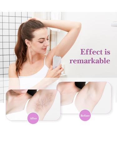 Smooth Glide Epilator for Women - Facial Hair Removal Tool for Face, Legs, Arms, Armpits, and Bikini Area - Buy Online on SooperMarket.com