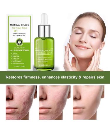 Goopgen Advanced Scar Repair Serum 30ML - Nature Scar Treatment - Scar Removal Serum for All Types of Scars (1PC) - Buy Online on SooperMarket.com