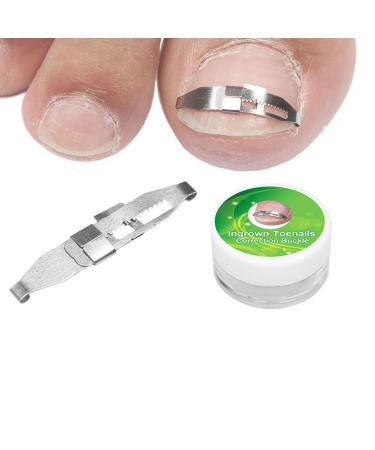Ingrown Toenail Treatment Stainless Steel Ingrown Toenail Corrector Relief Paronychia Treatment Correcting Tool