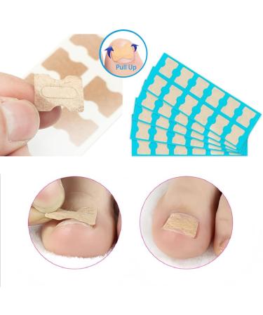Toenail Patch Ingrown Toenail Toenail Correction Toenail Correction Patch Toenail Correction Patch Ingrown Toenail Nail Care 50 Pieces - Buy Online on SooperMarket.com
