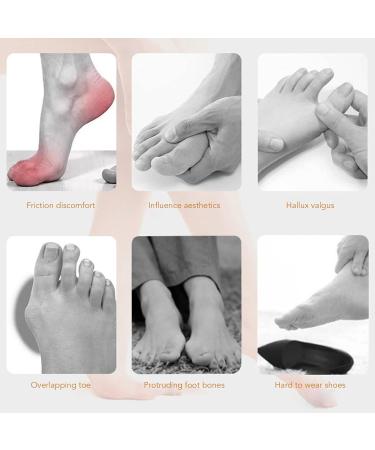 Bunion Separator Sleeve - Flexible & Slip-Preventing Corrector for Toe Valgus (Size L) - Buy Online on SooperMarket.com