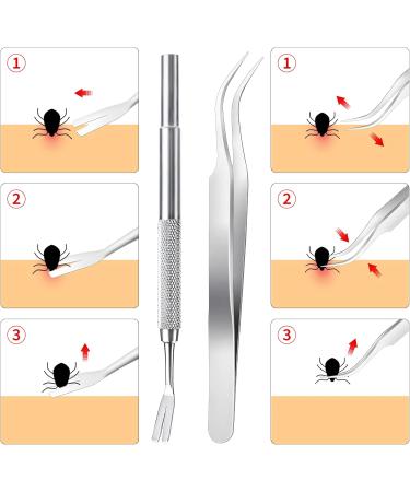 Melliex Tick Pliers Set - 6-Pack Stainless Steel Tick Removers for Humans Dogs Cats & Children | Safe & Easy Tick Removal with Storage Box - Buy Online on SooperMarket.com